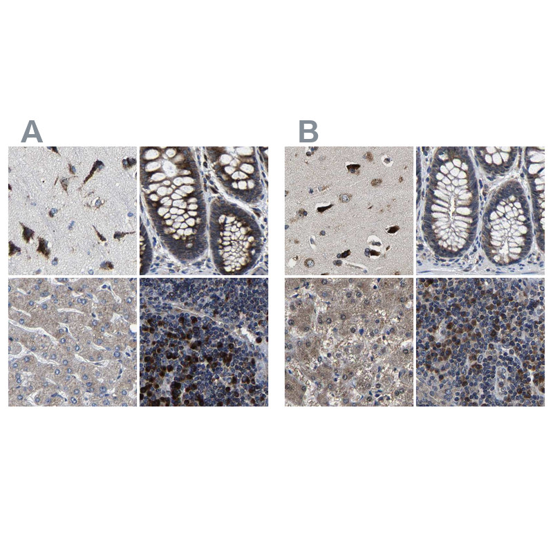 Immunohistochemical staining of human cerebral cortex, colon, liver and lymph node using Anti-EBAG9 antibody HPA021154 (A) shows similar protein distribution across tissues to independent antibody HPA021153 (B).