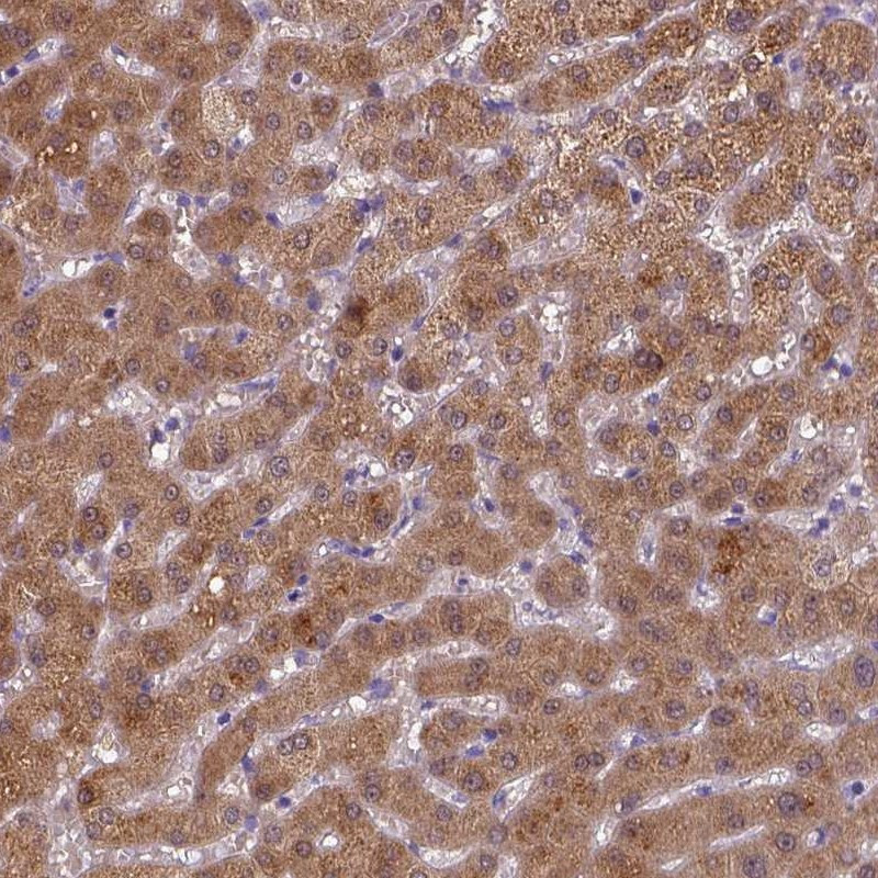 Immunohistochemical staining of human liver shows cytoplasmic positivity in hepatocytes.