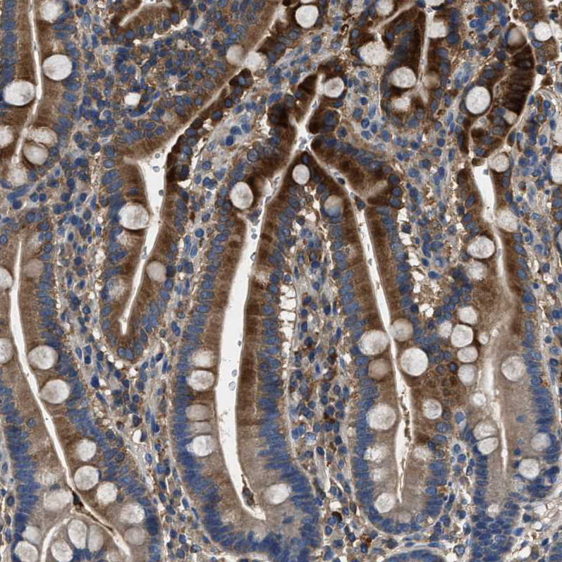 Immunohistochemical staining of human duodenum shows strong cytoplasmic positivity in glandular cells.