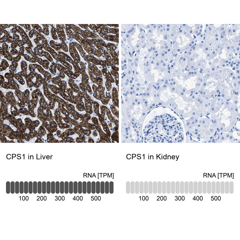 Immunohistochemistry analysis in human liver and kidney tissues using HPA021400 antibody. Corresponding CPS1 RNA-seq data are presented for the same tissues.