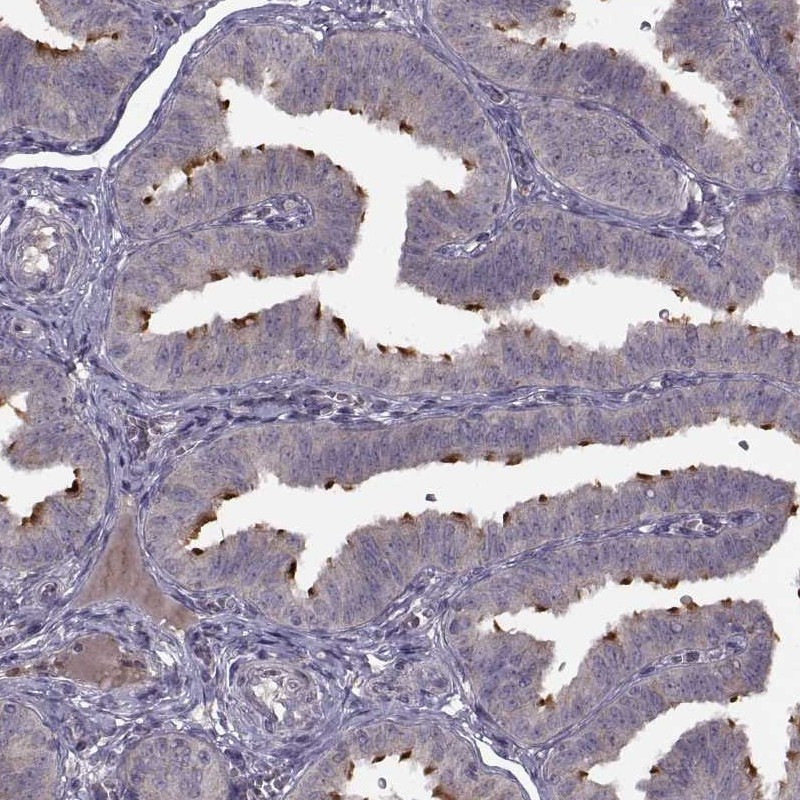 Immunohistochemical staining of human fallopian tube shows strong positivity in cilia of glandular cells.