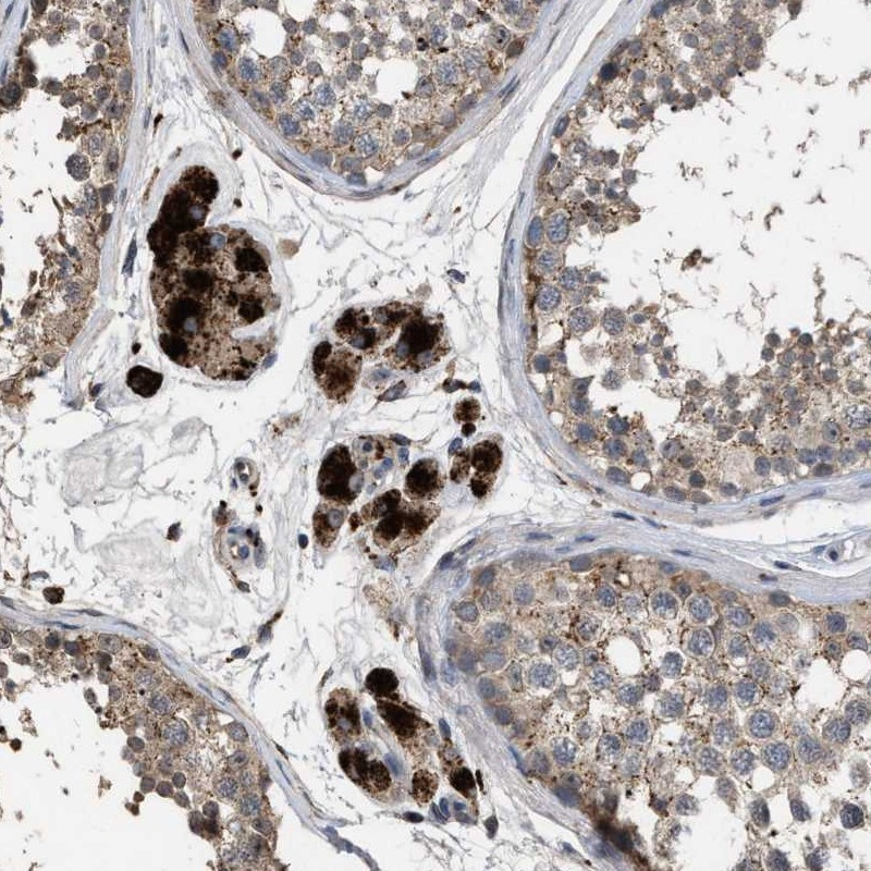 Immunohistochemical staining of human testis shows strong positivity in Leydig cells.