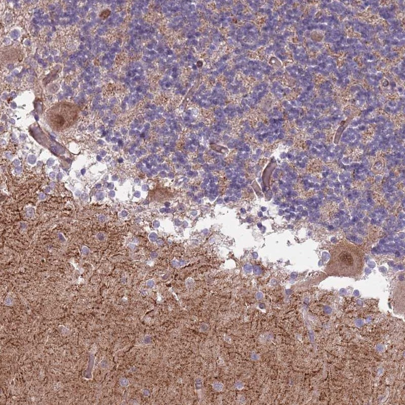 Immunohistochemical staining of human cerebellum shows moderate nuclear and cytoplasmic positivity in Purkinje cells.