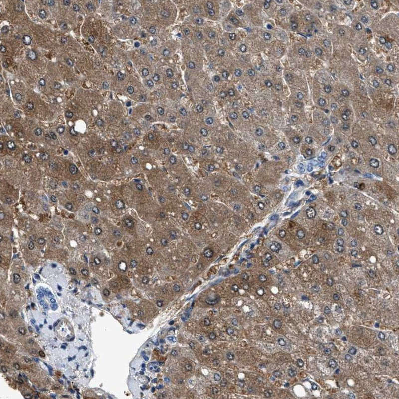 Immunohistochemical staining of human liver shows moderate cytoplasmic positivity in hepatocytes and bile duct cells are negative.