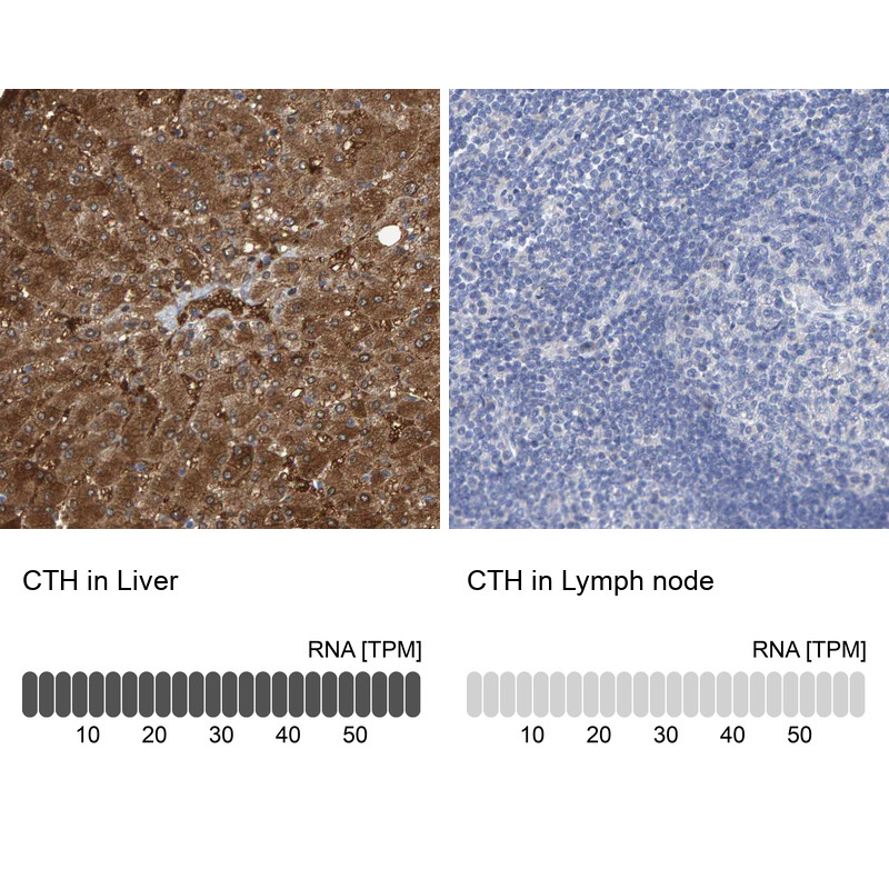 Immunohistochemistry analysis in human liver and lymph node tissues using Anti-CTH antibody. Corresponding CTH RNA-seq data are presented for the same tissues.