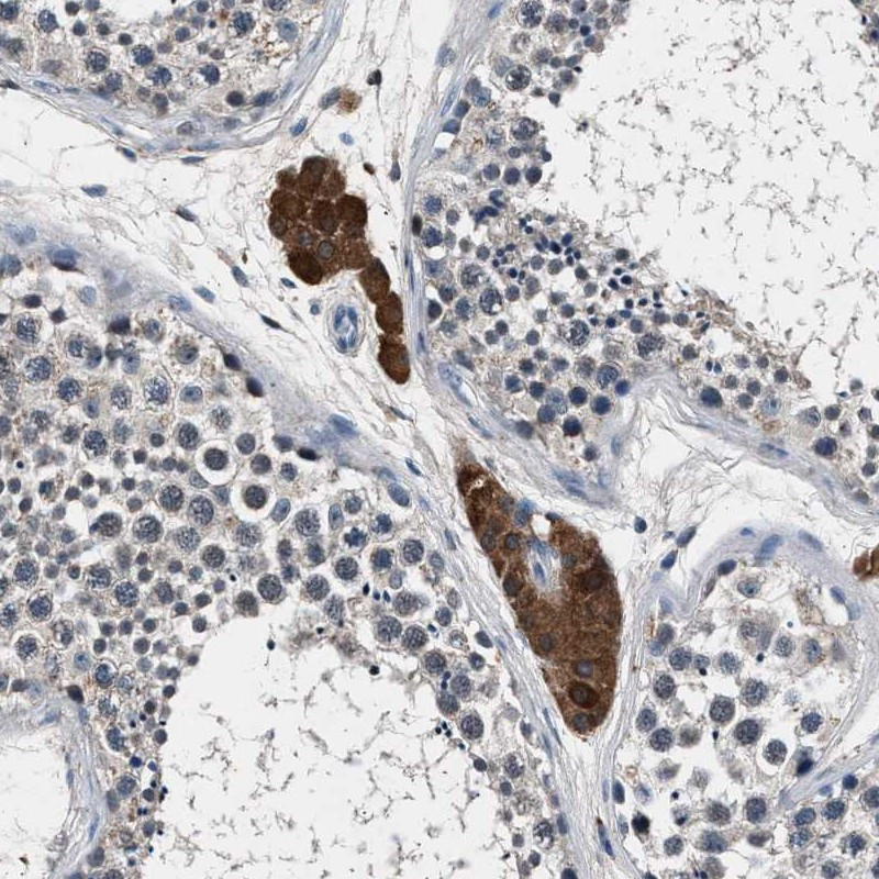 Immunohistochemical staining of human testis shows distinct cytoplasmic positivity in Leydig cells.