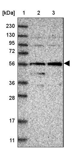 Lane 1: Marker [kDa] 230, 130, 95, 72, 56, 36, 28, 17, 11<br/>Lane 2: Human cell line RT-4<br/>Lane 3: Human cell line U-251MG sp