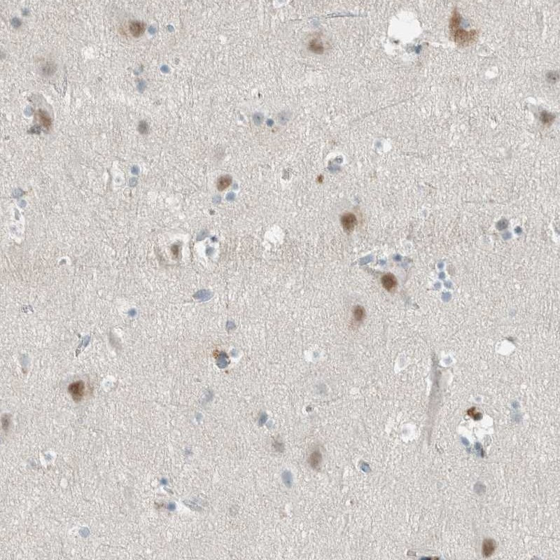 Immunohistochemical staining of human cerebral cortex shows moderate nuclear and cytoplasmic positivity in neuronal cells.
