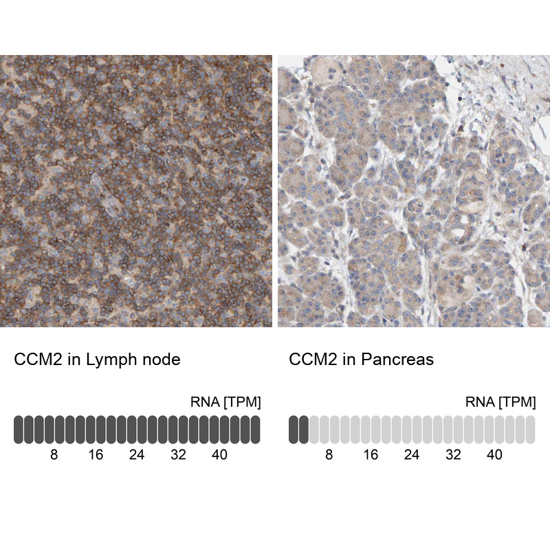 Immunohistochemistry analysis in human lymph node and pancreas tissues using HPA021669 antibody. Corresponding CCM2 RNA-seq data are presented for the same tissues.