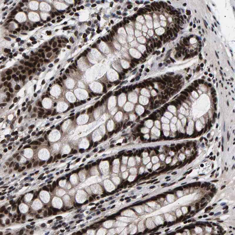 Immunohistochemical staining of human rectum shows strong nuclear positivity in glandular cells.
