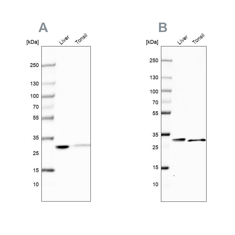 Western blot analysis using Anti-CA3 antibody HPA021775 (A) shows similar pattern to independent antibody HPA026700 (B).
