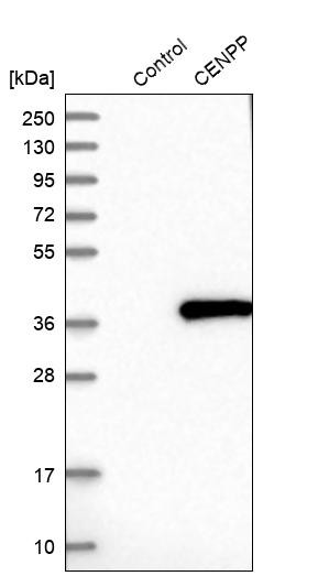 Western blot analysis in control (vector only transfected HEK293T lysate) and CENPP over-expression lysate (Co-expressed with a C-terminal myc-DDK tag (~3.1 kDa) in mammalian HEK293T cells, LY423313).