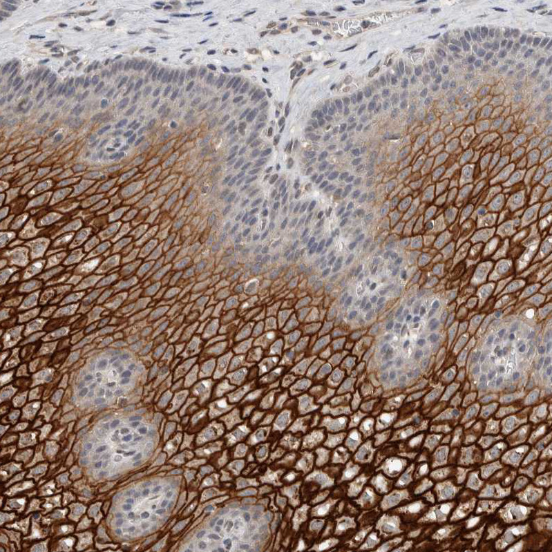 Immunohistochemical staining of human esophagus shows strong membranous positivity in squamous epithelial cells.