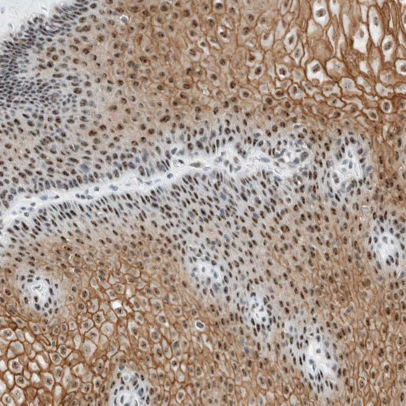 Immunohistochemical staining of human esophagus shows nuclear and cytoplasmic positivity in squamous epithelial cells.