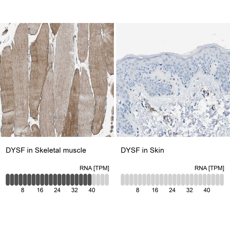 Immunohistochemistry analysis in human skeletal muscle and skin tissues using HPA021945 antibody. Corresponding DYSF RNA-seq data are presented for the same tissues.