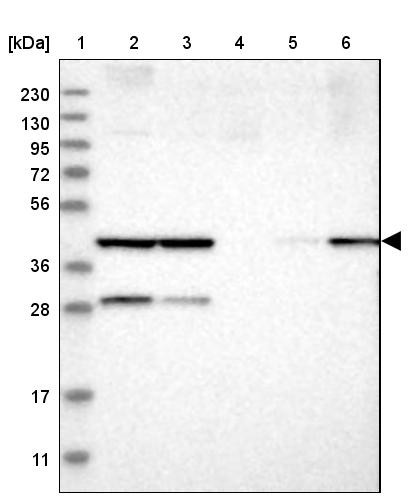 Lane 1: Marker [kDa] 230, 130, 95, 72, 56, 36, 28, 17, 11<br/>Lane 2: Human cell line RT-4<br/>Lane 3: Human cell line U-251MG sp<br/>Lane 4: Human plasma (IgG/HSA depleted)<br/>Lane 5: Human liver tissue<br/>Lane 6: Human tonsil tissue