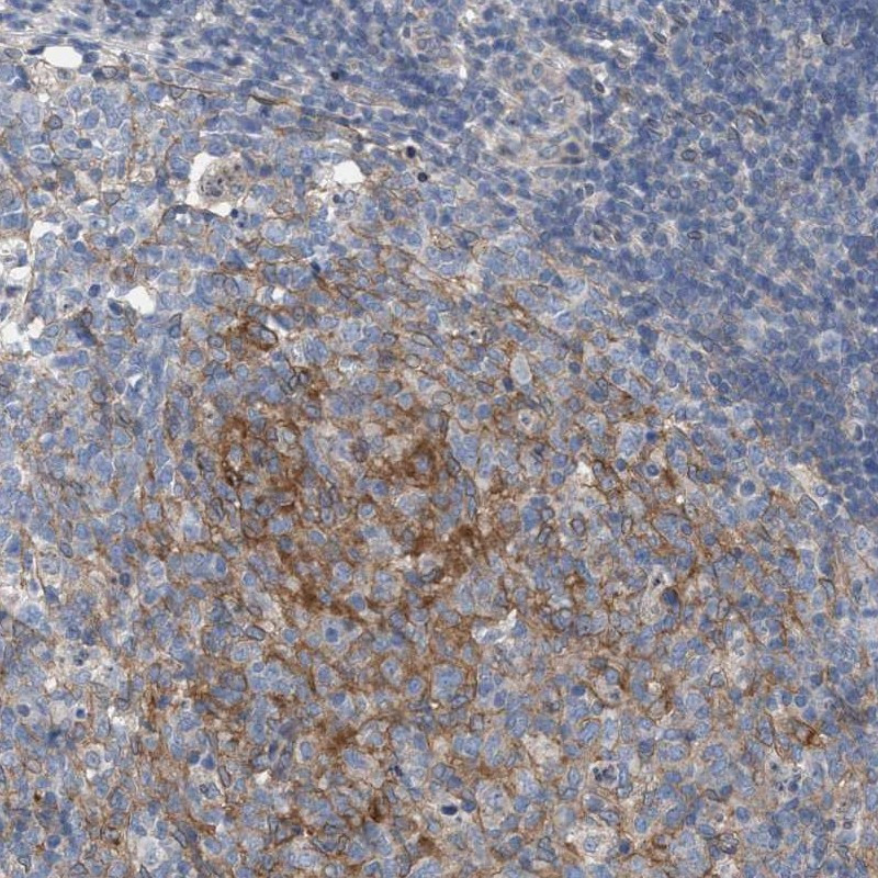 Immunohistochemical staining of human appendix shows cytoplasmic positivity in germinal center.