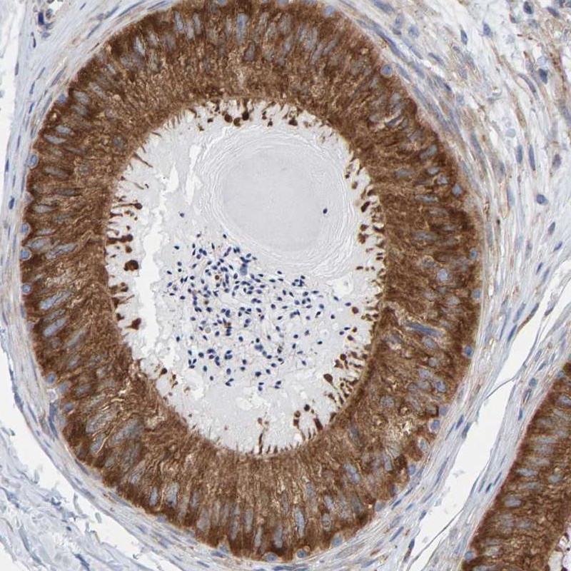 Immunohistochemical staining of human epididymis shows strong cytoplasmic positivity in glandular cells.