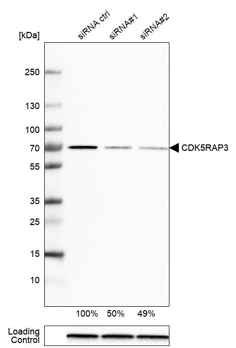 Western blot analysis in MCF-7 cells transfected with control siRNA, target specific siRNA probe #1 and #2, using Anti-CDK5RAP3 antibody. Remaining relative intensity is presented. Loading control: Anti-GAPDH.