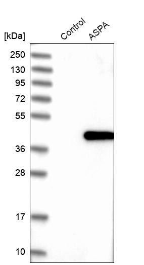 Western blot analysis in control (vector only transfected HEK293T lysate) and ASPA over-expression lysate (Co-expressed with a C-terminal myc-DDK tag (~3.1 kDa) in mammalian HEK293T cells, LY424954).