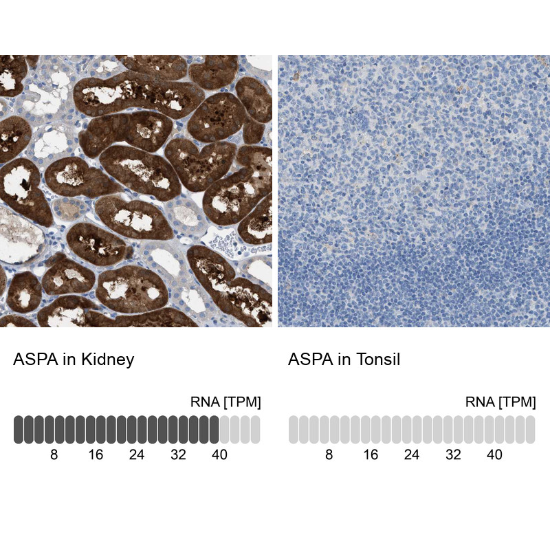 Immunohistochemistry analysis in human kidney and tonsil tissues using HPA022142 antibody. Corresponding ASPA RNA-seq data are presented for the same tissues.