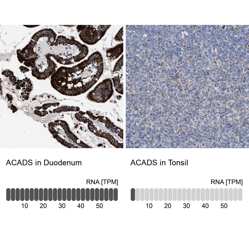 Immunohistochemistry analysis in human duodenum and tonsil tissues using HPA022271 antibody. Corresponding ACADS RNA-seq data are presented for the same tissues.