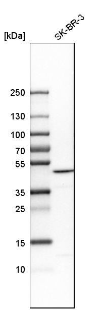Western blot analysis in human cell line SK-BR-3.