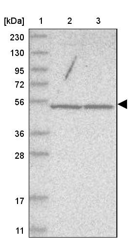 Lane 1: Marker [kDa] 230, 130, 95, 72, 56, 36, 28, 17, 11<br/>Lane 2: Human cell line RT-4<br/>Lane 3: Human cell line U-251MG sp
