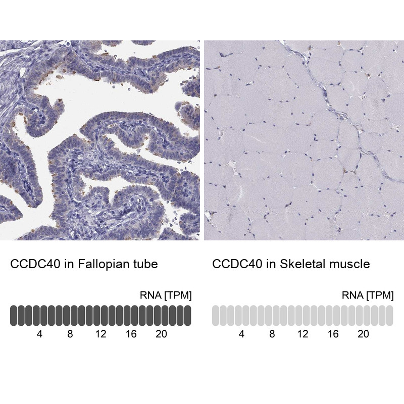Immunohistochemistry analysis in human fallopian tube and skeletal muscle tissues using Anti-CCDC40 antibody. Corresponding CCDC40 RNA-seq data are presented for the same tissues.