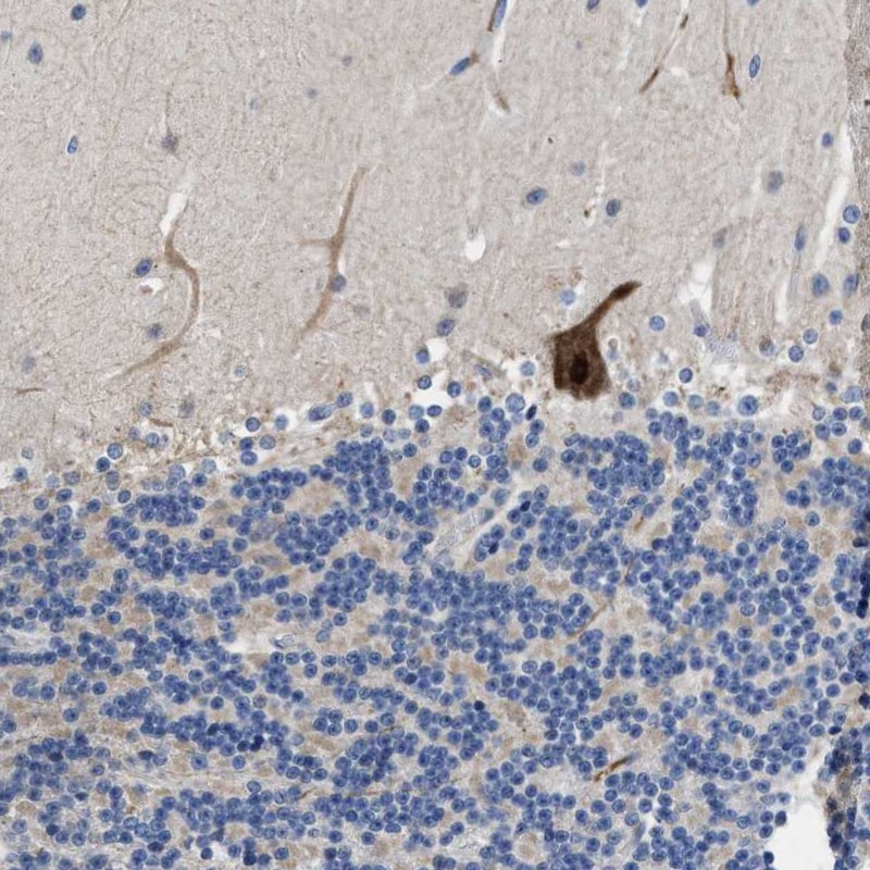 Immunohistochemical staining of human cerebellum shows strong nuclear and cytoplasmic positivity in purkinje cells.