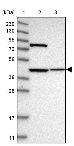 Lane 1: Marker [kDa] 230, 130, 95, 72, 56, 36, 28, 17, 11<br/>Lane 2: Human cell line RT-4<br/>Lane 3: Human cell line U-251MG sp