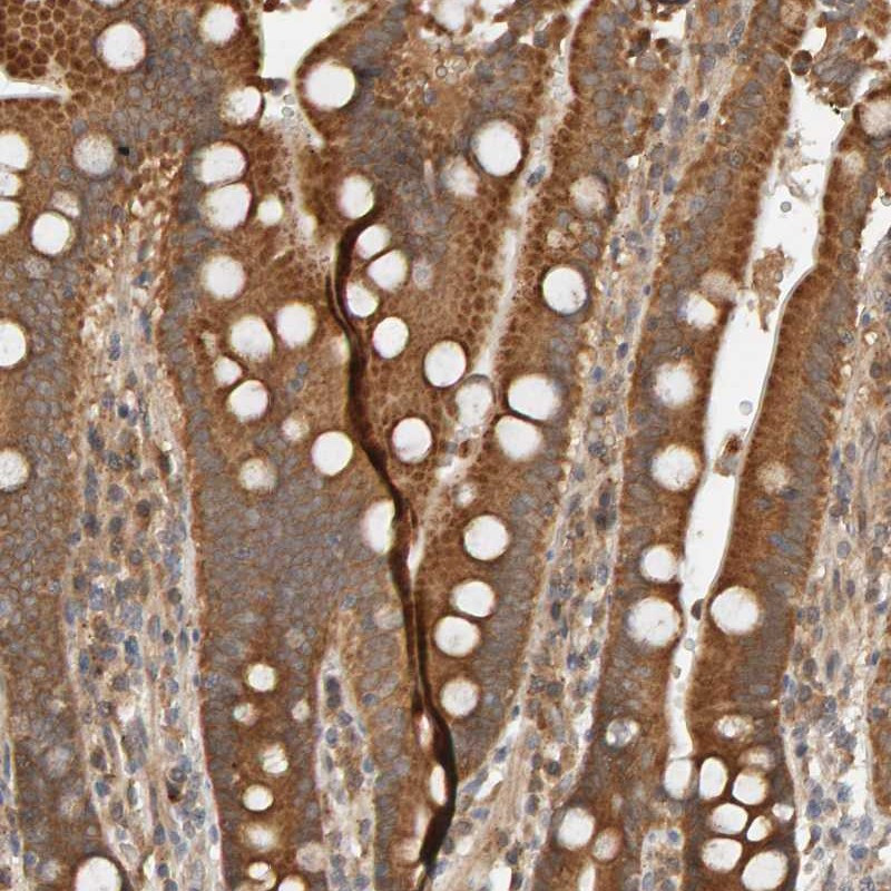 Immunohistochemical staining of human duodenum shows distinct cytoplasmic positivity in glandular cells.
