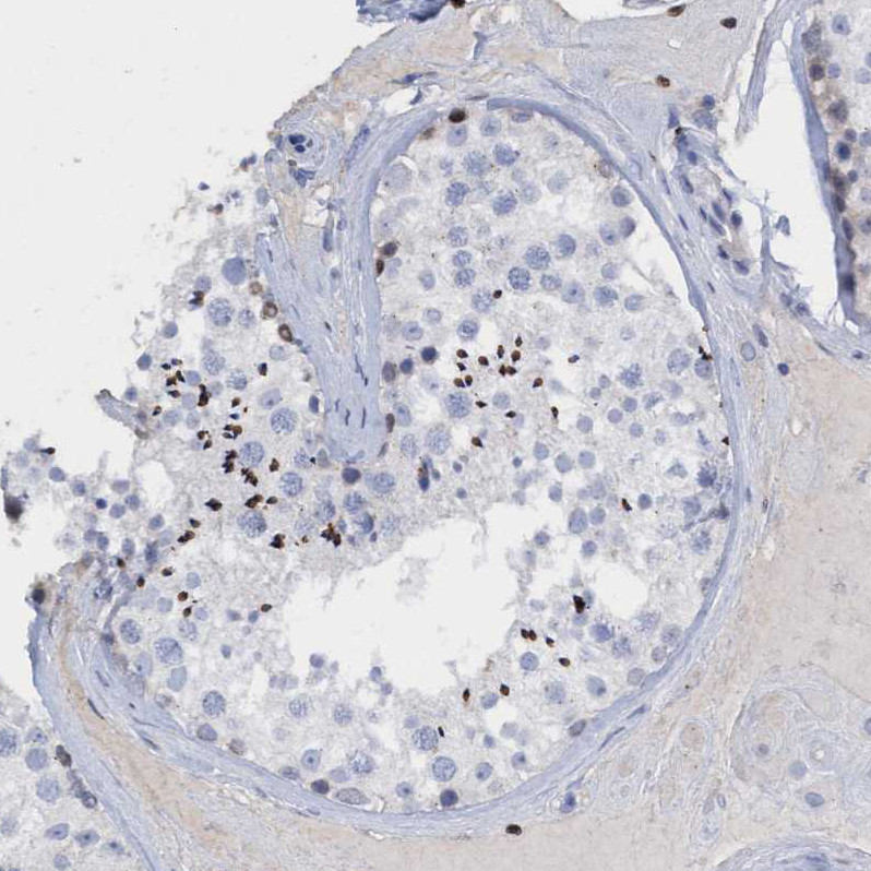 Immunohistochemical staining of human testis shows strong nuclear positivity in cells in seminiferous ducts.