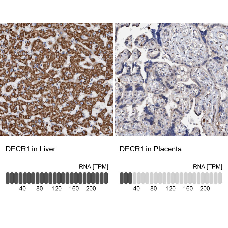 Immunohistochemistry analysis in human liver and placenta tissues using Anti-DECR1 antibody. Corresponding DECR1 RNA-seq data are presented for the same tissues.