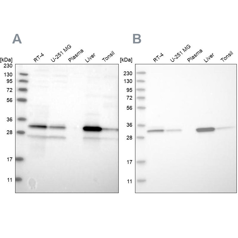 Western blot analysis using Anti-DECR1 antibody HPA023162 (A) shows similar pattern to independent antibody HPA023238 (B).
