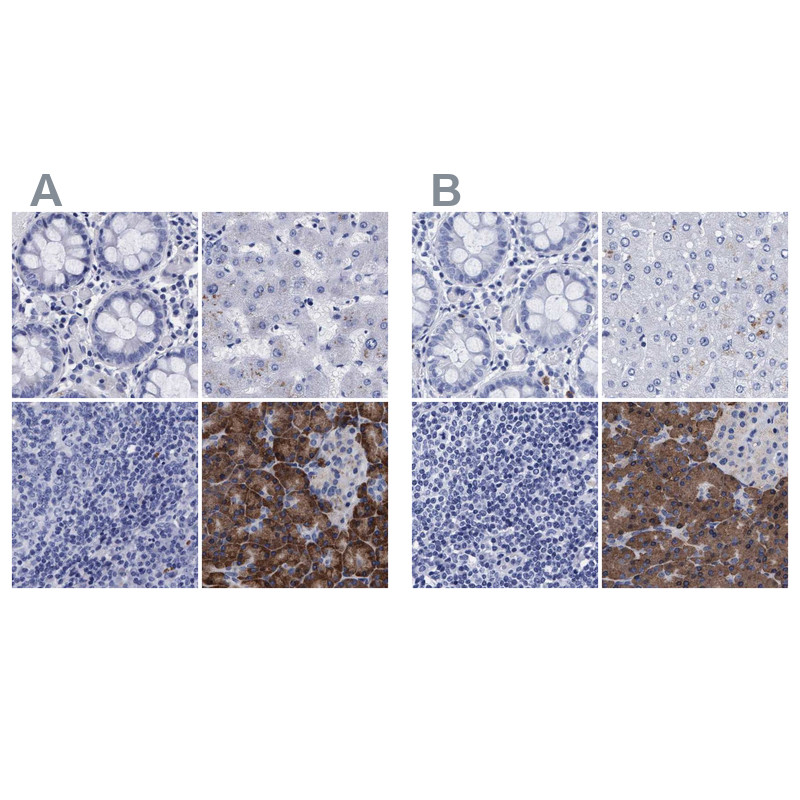 Immunohistochemical staining of human colon, liver, lymph node and pancreas using Anti-ARSG antibody HPA023245 (A) shows similar protein distribution across tissues to independent antibody HPA023285 (B).