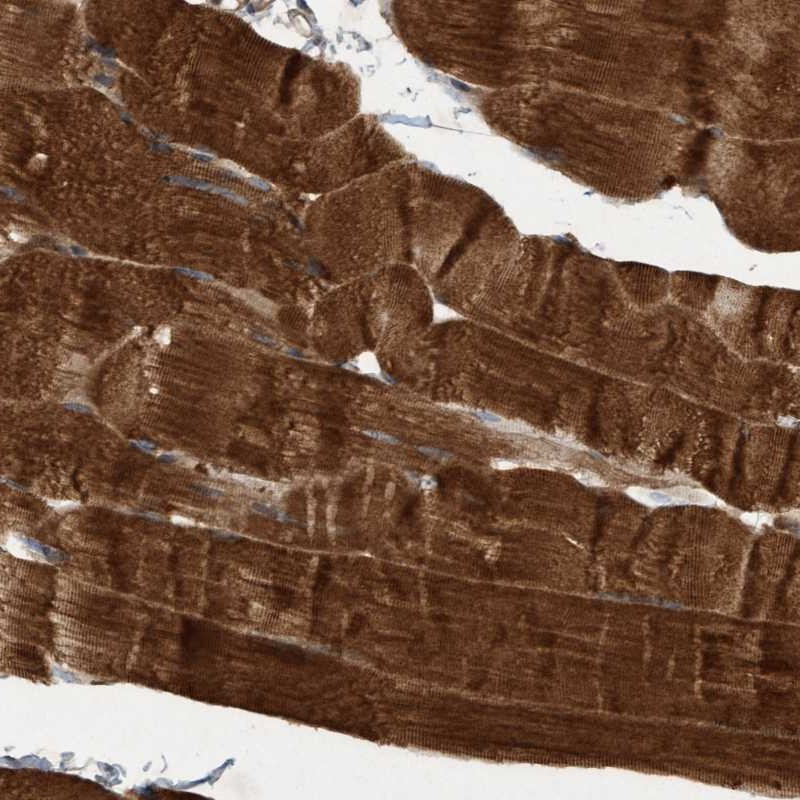 Immunohistochemical staining of human skeletal muscle shows strong cytoplasmic positivity in myocytes.