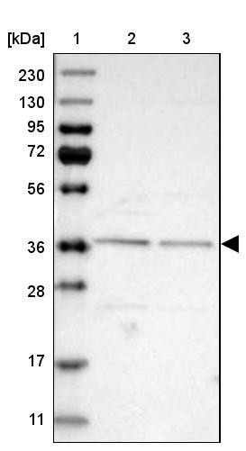 Lane 1: Marker [kDa] 230, 130, 95, 72, 56, 36, 28, 17, 11<br/>Lane 2: Human cell line RT-4<br/>Lane 3: Human cell line U-251MG sp