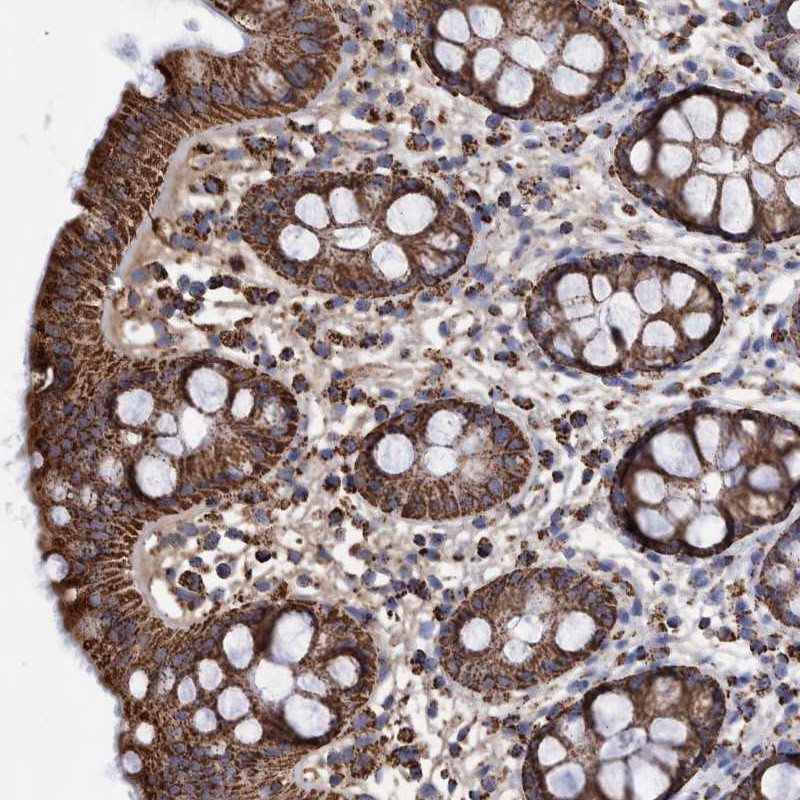 Immunohistochemical staining of human rectum shows strong cytoplasmic positivity in granular pattern in glandular cells.