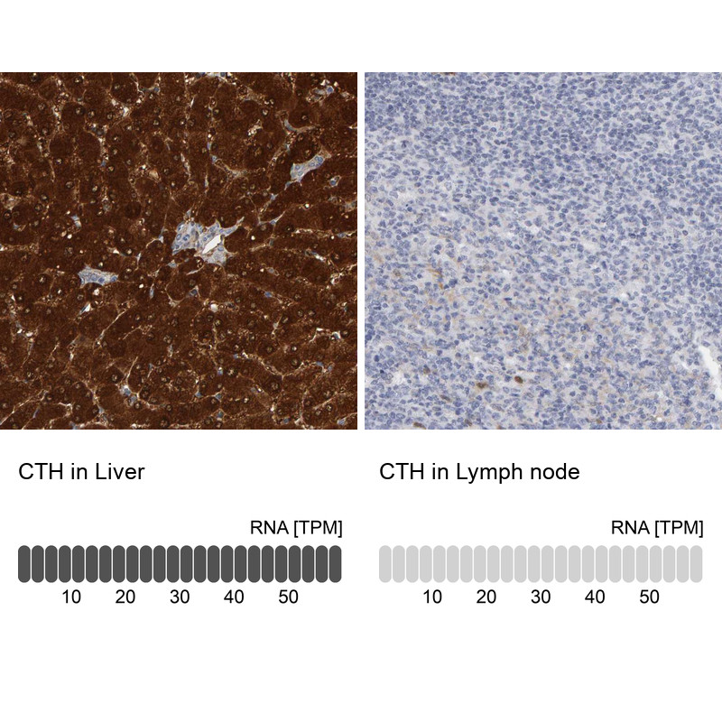 Immunohistochemistry analysis in human liver and lymph node tissues using Anti-CTH antibody. Corresponding CTH RNA-seq data are presented for the same tissues.