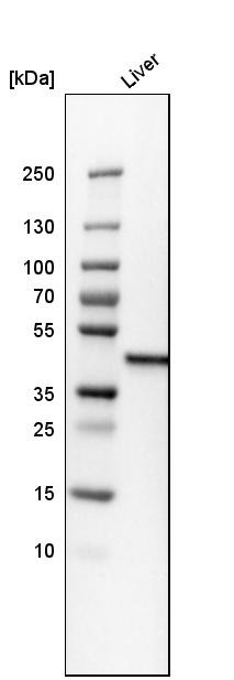 Western blot analysis in human liver tissue.