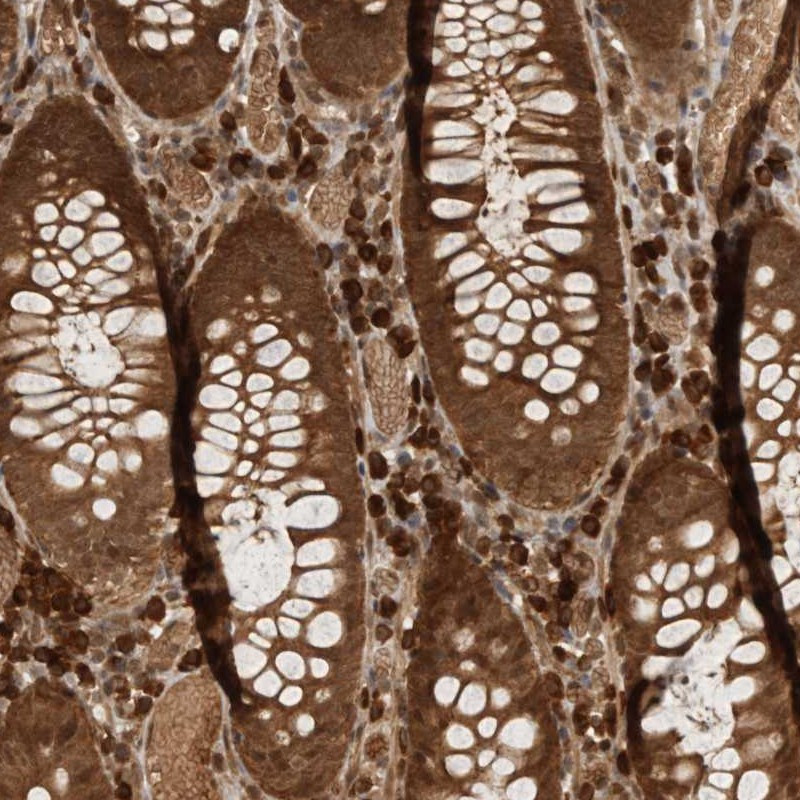 Immunohistochemical staining of human colon shows strong cytoplasmic and nuclear positivity in glandular cells.