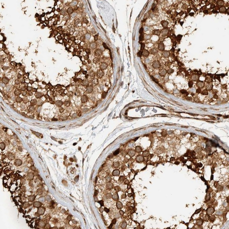 Immunohistochemical staining of human testis shows strong cytoplasmic positivity in Leydig cells and cells in seminiferous ducts.