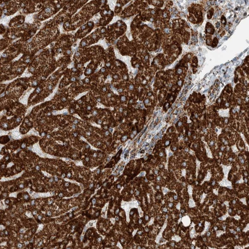 Immunohistochemical staining of human liver shows strong cytoplasmic positivity in hepatocytes.