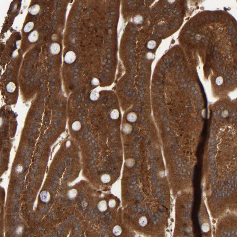 Immunohistochemical staining of human duodenum shows strong cytoplasmic positivity in glandular cells.