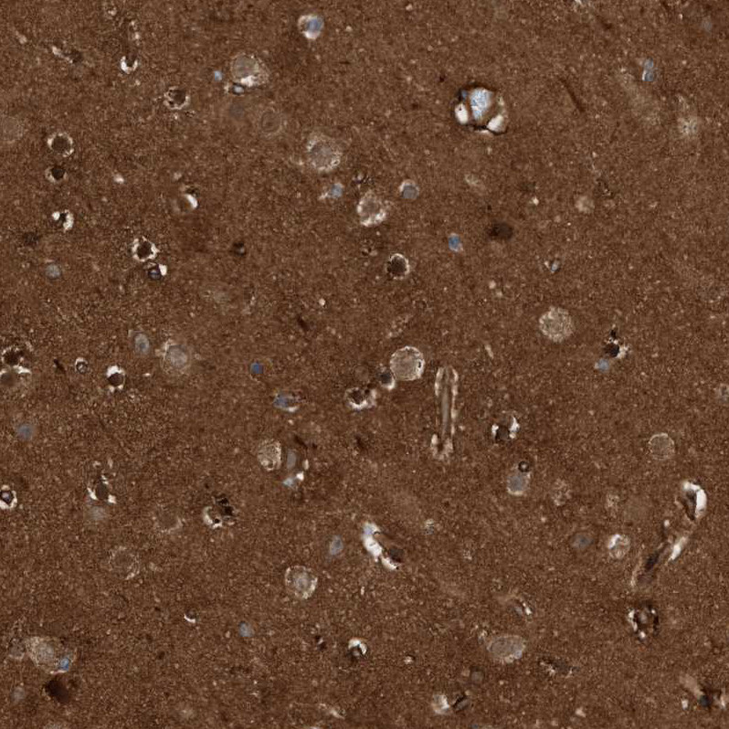 Immunohistochemical staining of human cerebral cortex shows strong cytoplasmic positivity in neuropil.