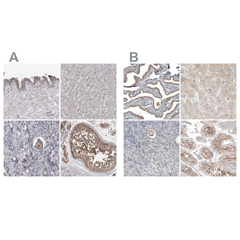 Immunohistochemical staining of human fallopian tube, liver, ovary and testis using Anti-PCM1 antibody HPA023374 (A) shows similar protein distribution across tissues to independent antibody HPA023370 (B).