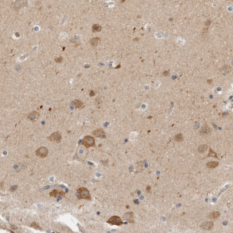 Immunohistochemical staining of human cerebral cortex shows moderate cytoplasmic positivity in neurons.