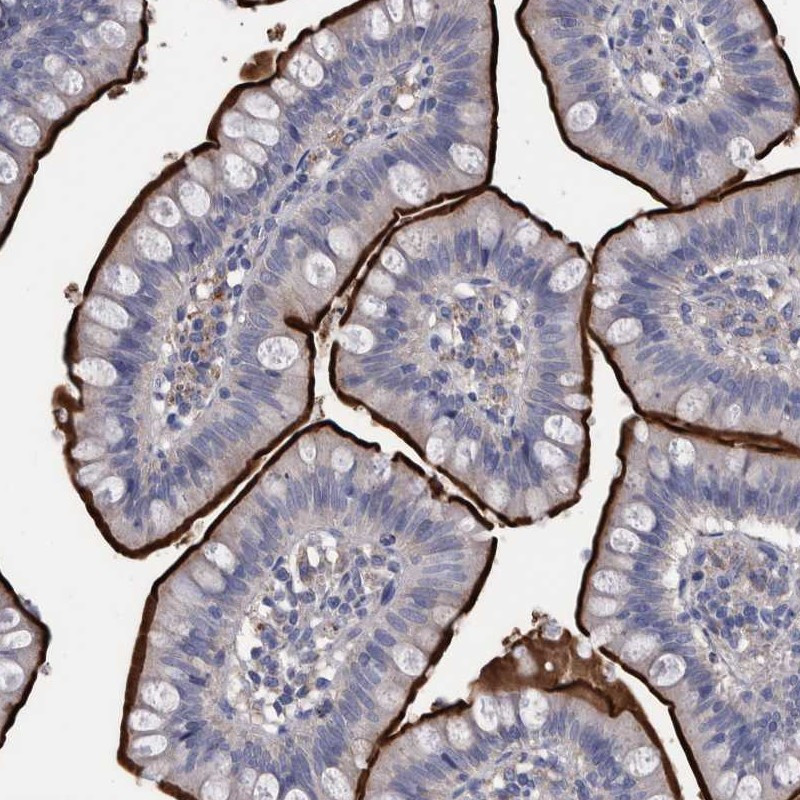 Immunohistochemical staining of human small intestine shows strong membranous positivity in glandular cells.