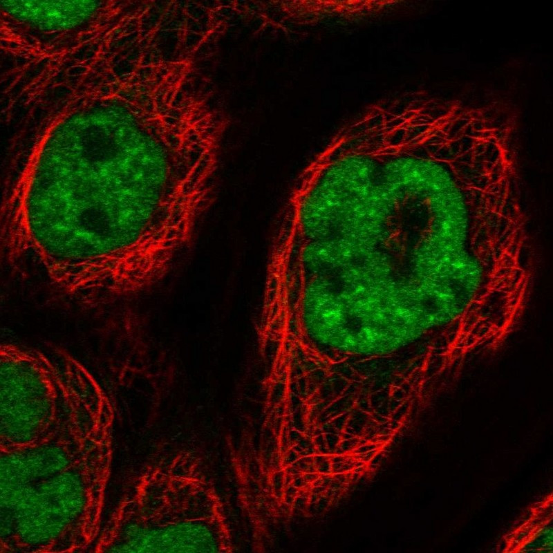 Immunofluorescent staining of human cell line A-431 shows localization to nuclear speckles.